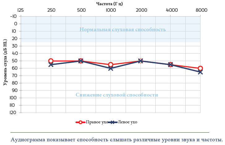 7 понятий аудиометрии-1